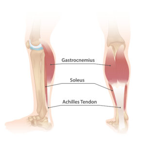 Gastrocnemius, soleus and Achilles tendon