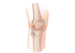 Pain in your knee joint