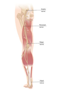 Sciatic nerve and tibial nerve